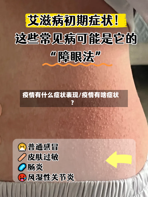 疫情有什么症状表现/疫情有啥症状?-第1张图片