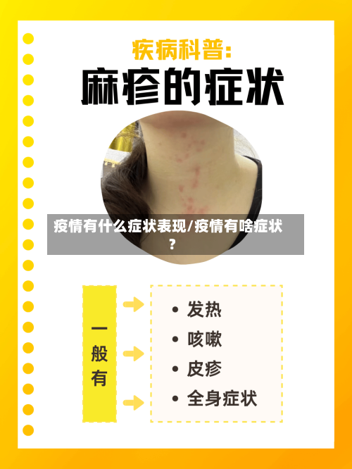 疫情有什么症状表现/疫情有啥症状?-第3张图片
